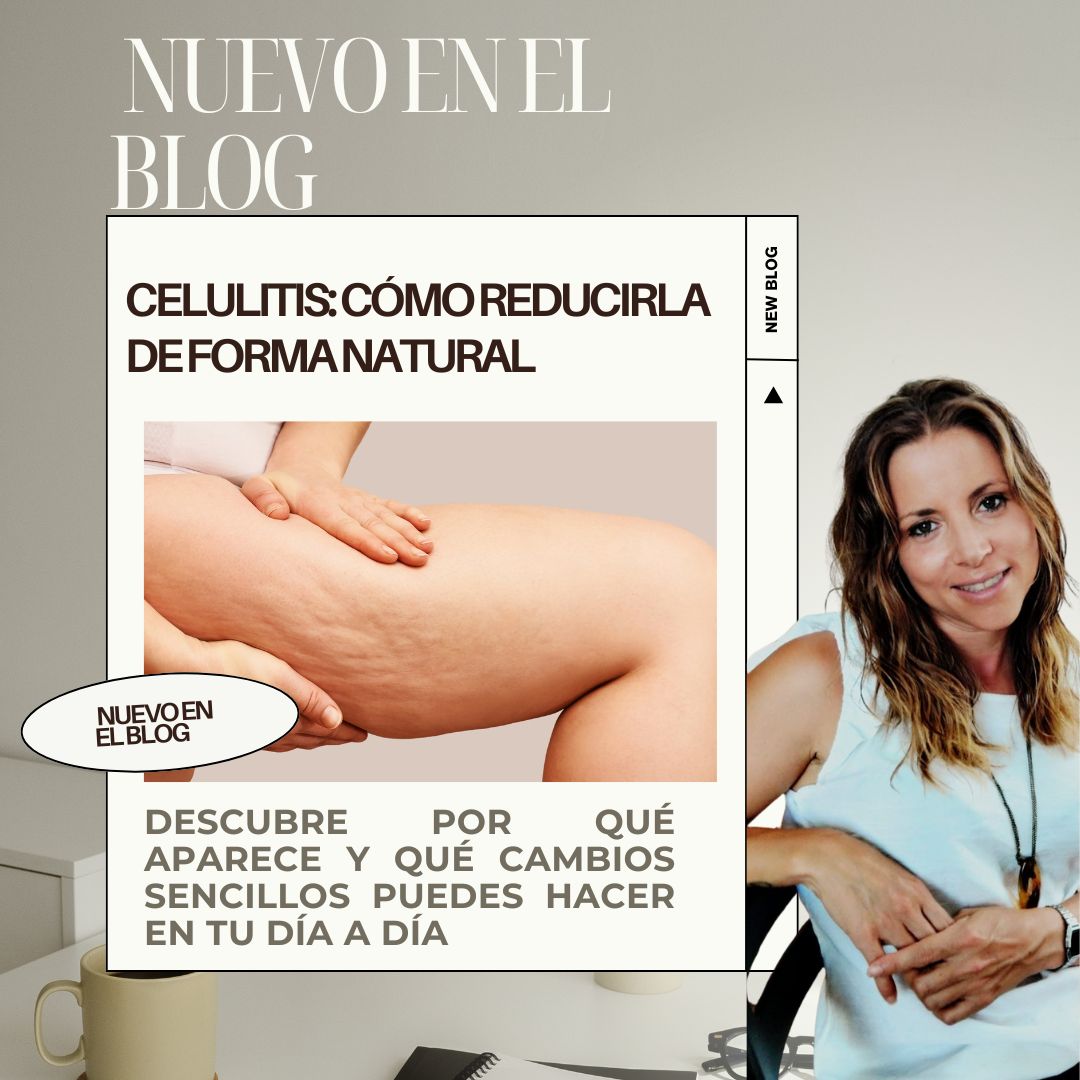 Celulitis: por qué aparece y cómo reducirla de forma natural